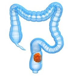 kolon icon